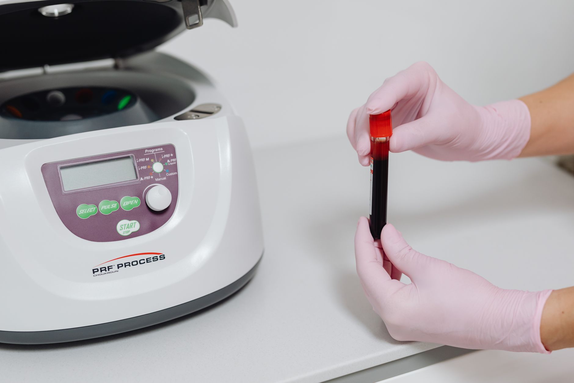 A blood sample being collected for laboratory analysis, representing the clinical measurement of microplastics in the bloodstream